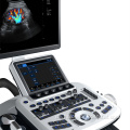 Medizinische diagnostische 3/d 4/d Ultraschall -Wireless -Farbdoppler